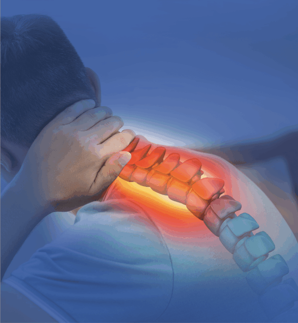 Cervogenic Headaches